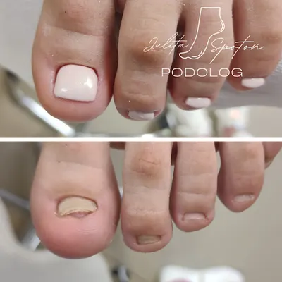 Podolog ZGIERZ Julita Spotoń Gabinet podologiczny